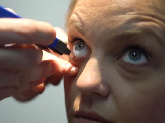 Medicina Oftalmologia Exame Avaliacao da Função Lacrimal